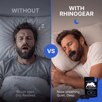 Mouth Tape for Sleeping - Gentle Nasal Breathing Strips for Snoring & Performance | 30 Pack | RhinoGear - RHINOGEAR